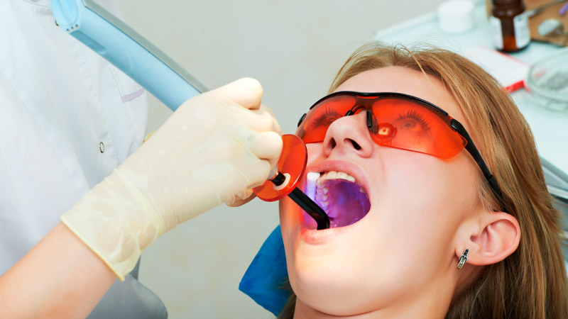 Realización de blanqueamiento dental en paciente